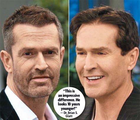 Ruperteverett