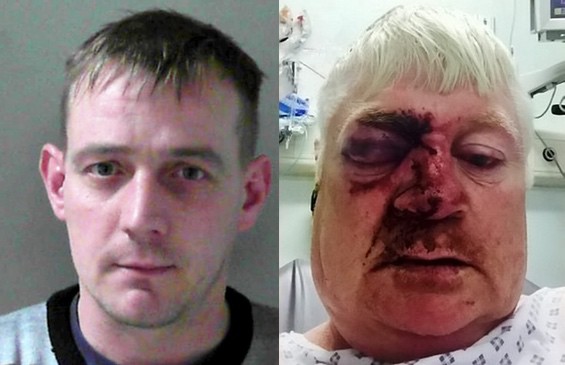 British Gay Man Speaks Out About Beating By Cage Fighter Keith Moult That Left Him For Dead 1 beating
