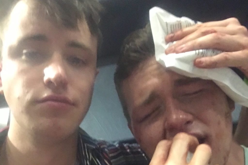 Hate Crime Added To Charges Against 3 Arrested For Attack On Gay D.c. Couple 1 attack couple