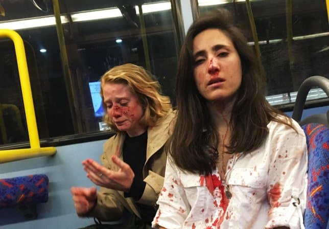 beaten couple