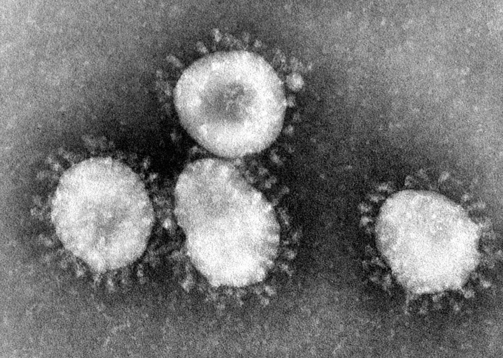Coronavirus: Cdc Recommends Ban On Events Over 50 People As Amazon Warns Of Delivery Delays 1 coronavirus