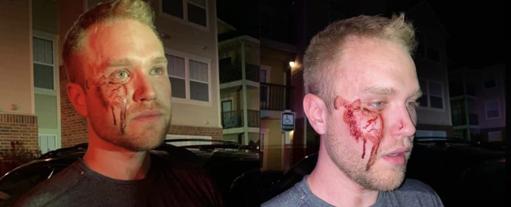'Are You Two A Couple Of Fags?' — Oklahoma Realtor Beaten Unconscious After Honking To Get Into Parking Space: Watch 1 Christian Council