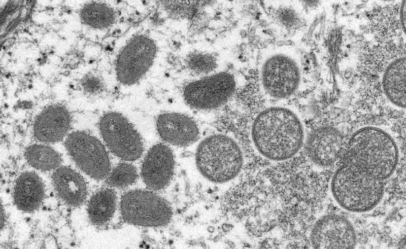 More Than 700 Monkeypox Cases Globally, 21 In Us: Cdc 1 583661 origin 1