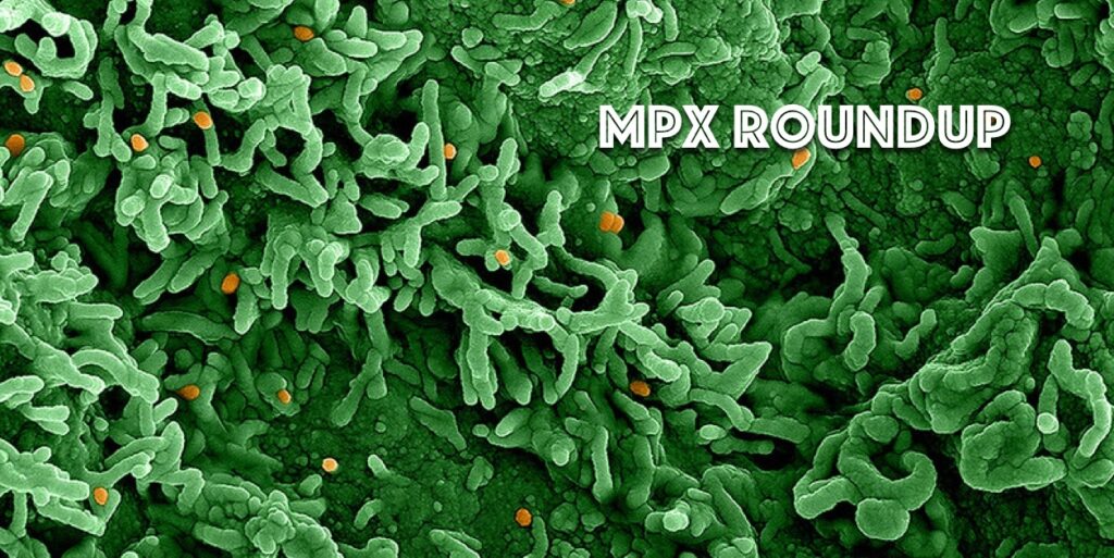 Mpx Is Monkeypox Is Everywhere; Cdc Undercounts Cases; 'Lesions, Headaches, Debilitating Pain... You Don'T Want This '; Roundup 1 mpx is monkeypox is everywhere