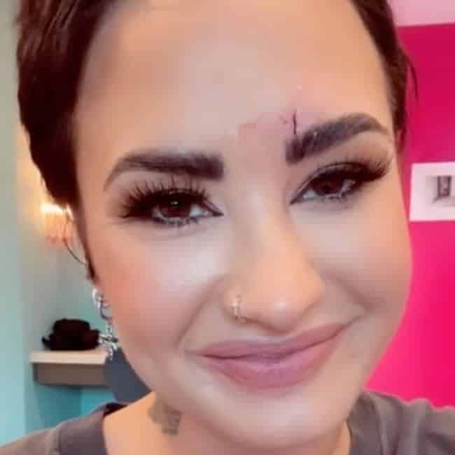 Demi Lovato Suffers Bloody Face Injury After Hitting Their Head On Crystal 1 596001 origin 1