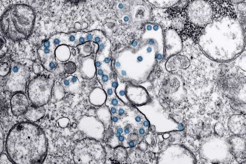 Omicron Seen As A Milder Coronavirus, But Scientists Aren'T So Sure 1 636688 origin 1