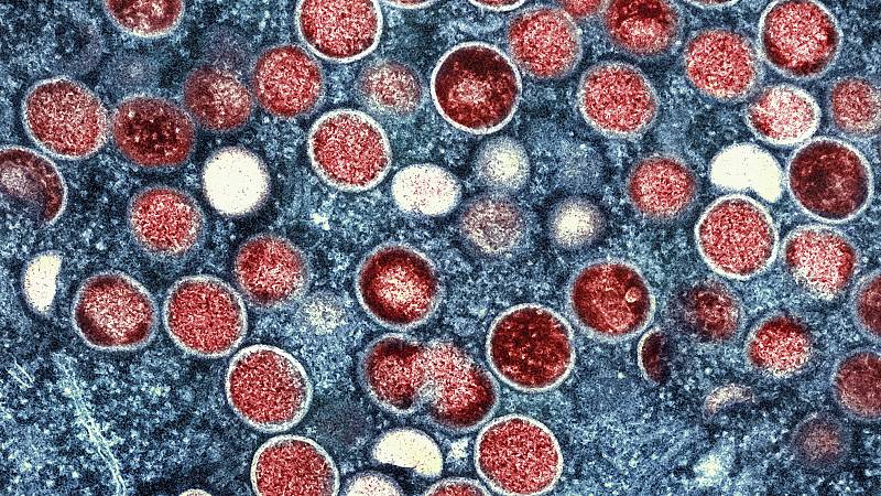 Twitter Failed To Tackle Lgbtq Monkeypox Hate Speech, Says Study 1 638185 origin 1